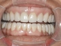 Konig Center for Cosmetic & Comprehensive Dentistry smile photos